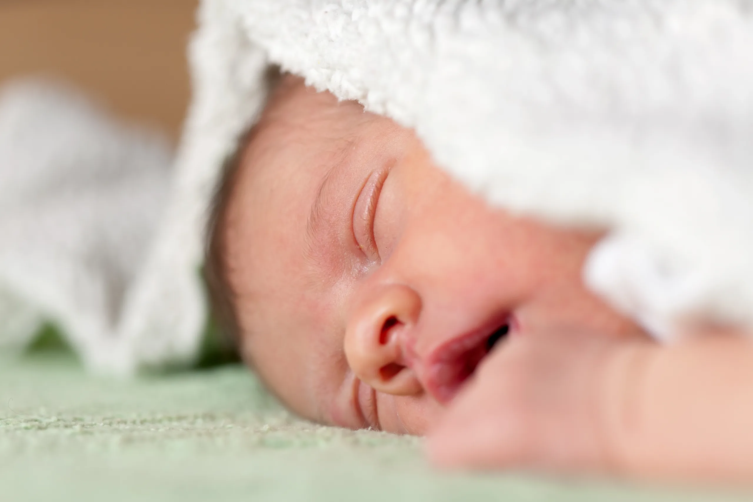 bebe prematuro retinopatia