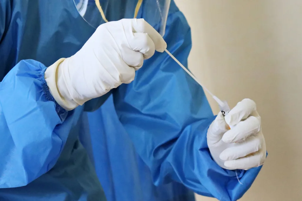 Alza histórica de sífilis en Chile: qué explica el incremento de una infección prevenible
