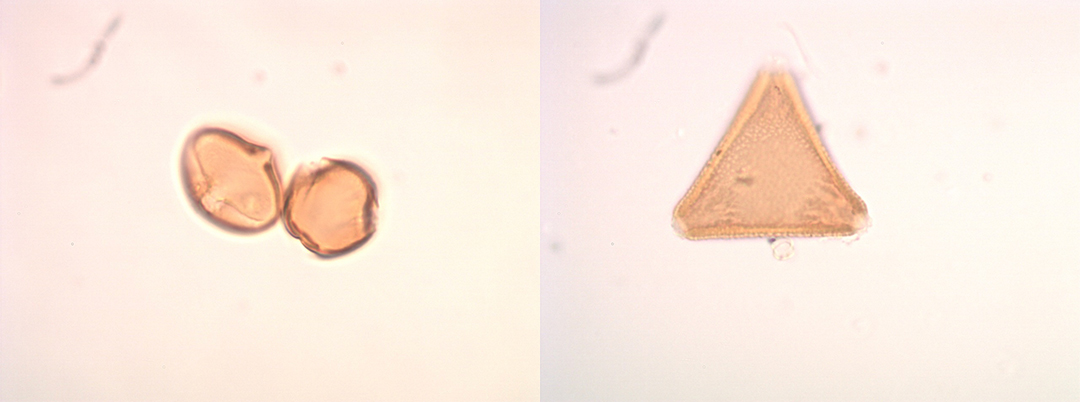 Imagen microscópica de granos de polen.