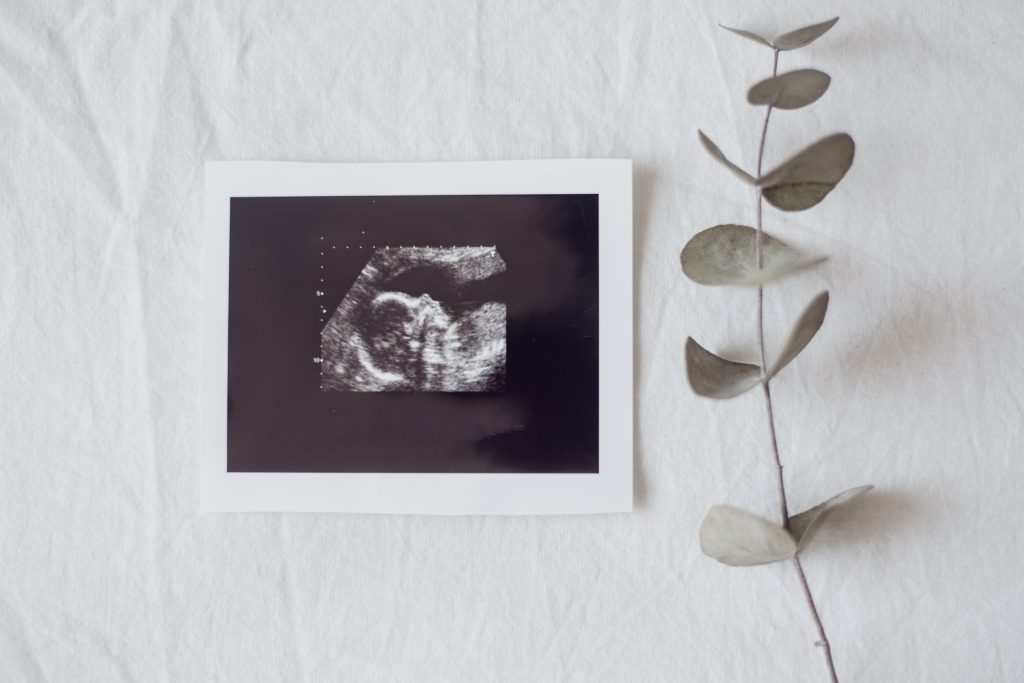 muerte gestacional, perinatal y neonatal