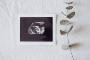 muerte gestacional, perinatal y neonatal