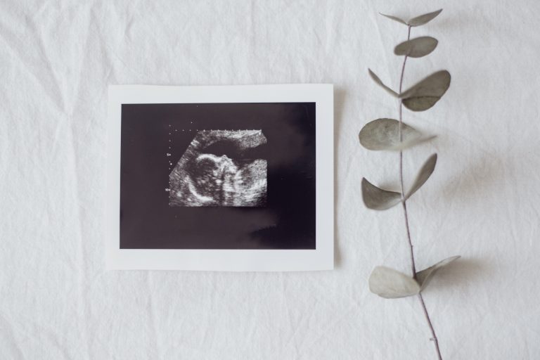 muerte gestacional, perinatal y neonatal